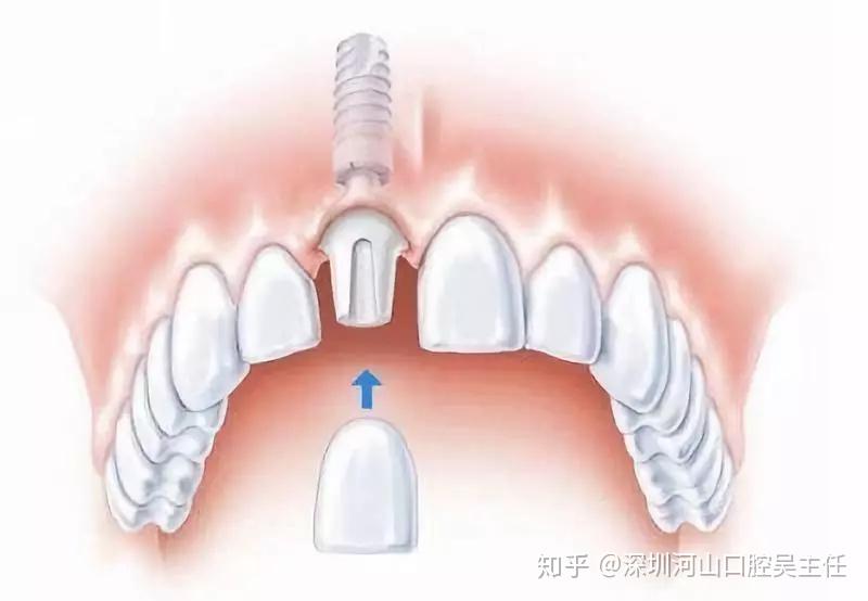 "老太婆毛片A级老太婆毛片,经典怀旧,高清修复,独家珍藏"