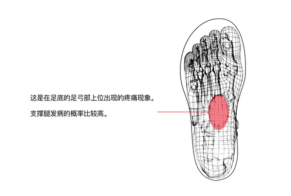 挠足TK一挠足vk挠脚心挑战，体验极致痒感，解锁足底敏感带，尝试不同挠法逗趣玩法