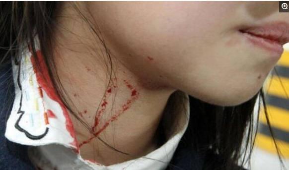 清纯女学生破苞出血浜引发热议，校园安全受关注，家长呼吁加强教育保护