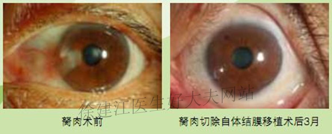 意大利电影胬肉治疗免费阅读浜，深度解析剧情与艺术价值，探索经典影片的独特魅力