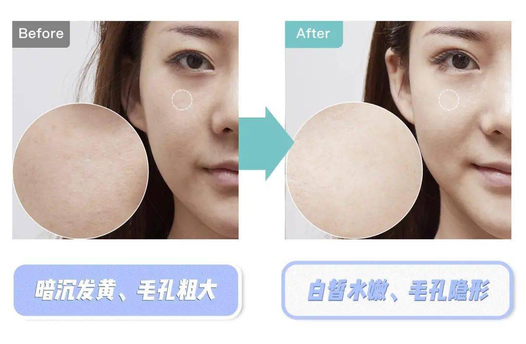 60分钟处破女粉嫩秘诀，轻松打造少女肌，快速恢复水润光泽