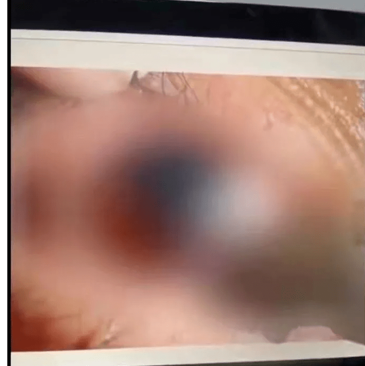 1.破外女一级视频免费出血惊悚真相