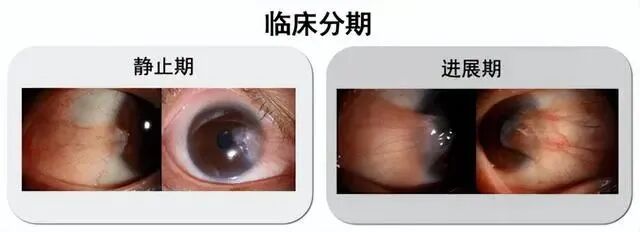 意大利电影胬肉治疗免费观看浜，高清完整版在线播放，精彩剧情不容错过