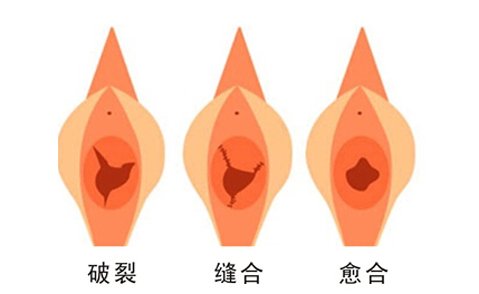 10至13岁女孩处女膜破裂视频，真实案例警示，家长必看防护指南