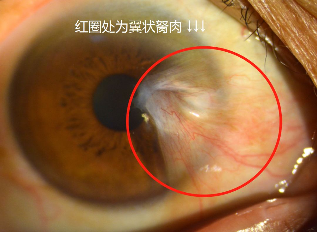意大利电影胬肉治疗免费阅读浜，深度解析剧情与艺术价值，探索经典影片的独特魅力