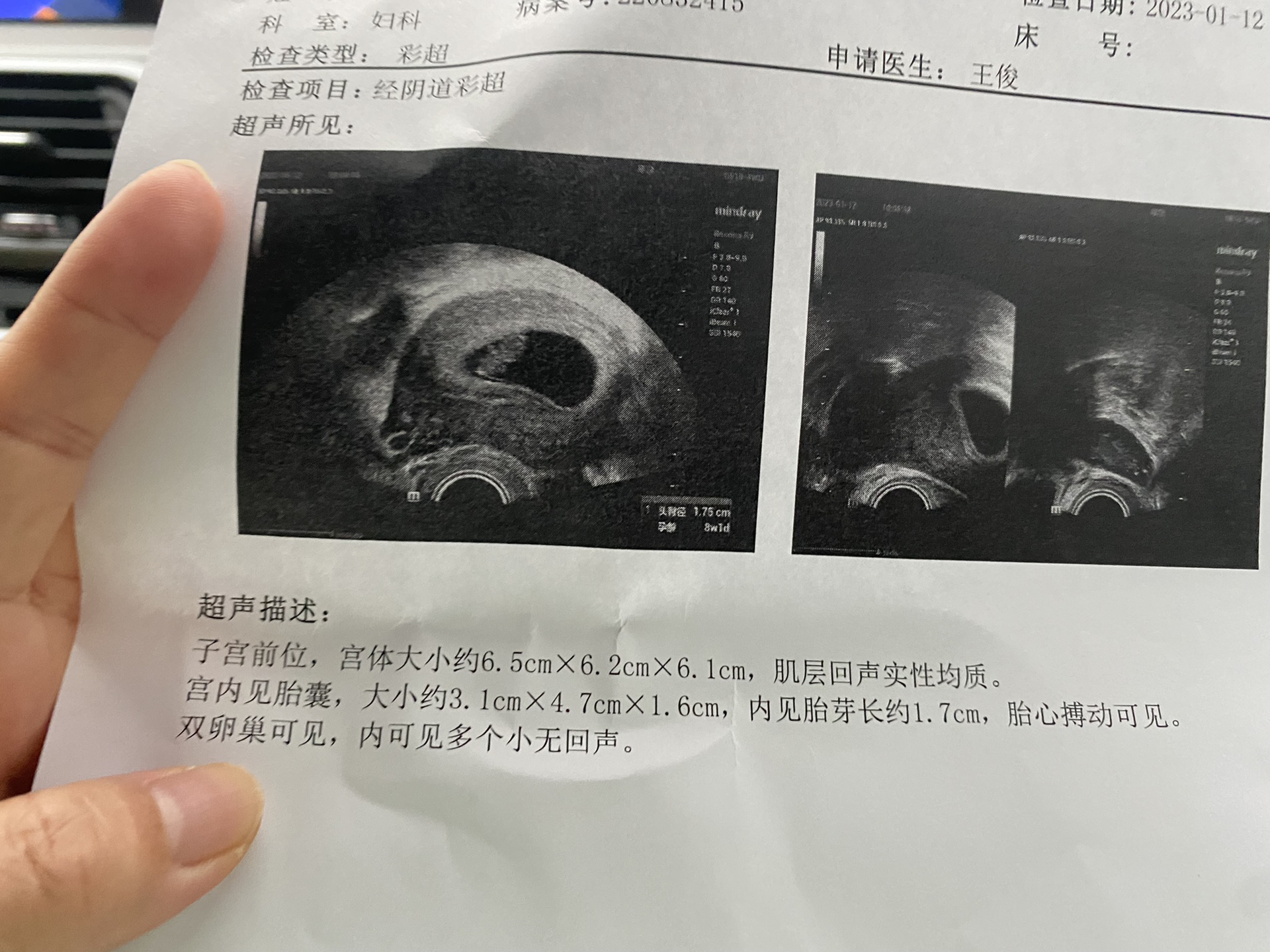 美女和男生一起努力的生孩子视频大全，真实记录备孕过程，感人至深的孕育故事，夫妻共同迎接新生命