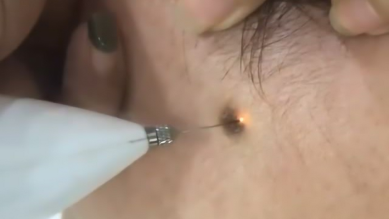 1.腋窝毛毛长出来3D视频过程全记录