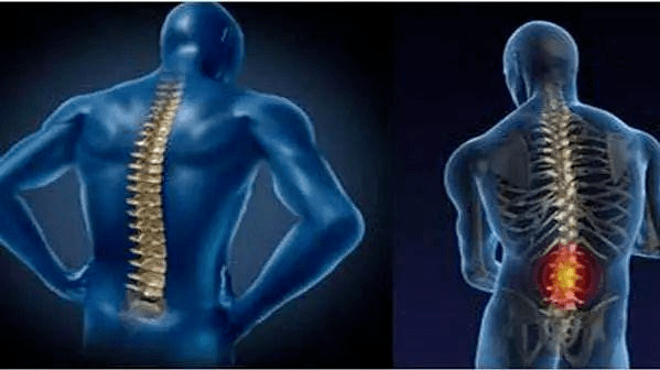 绳经病vK患者必看,5个康复秘诀,快速摆脱困扰重获健康生活 绳经病vK患者必看,5个康复秘诀,快速摆脱困扰重获健康生活