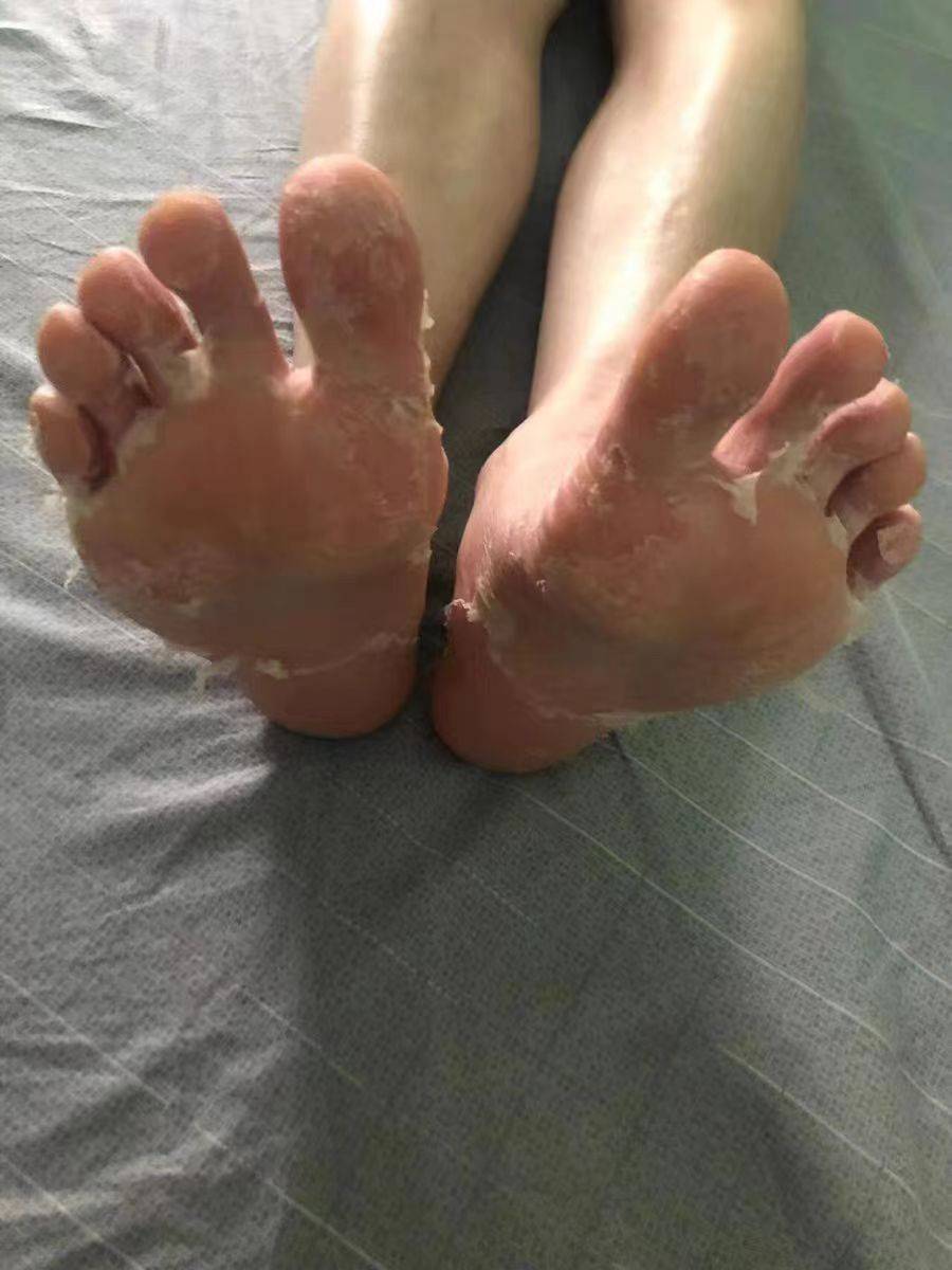 Vktk脚底板用油和刷子浜护理技巧，提升舒适度，享受健康足部体验