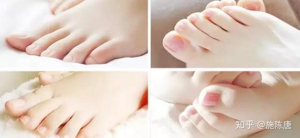 2.美脚社分享足部保养秘诀，轻松拥有迷人双足，告别粗糙干燥