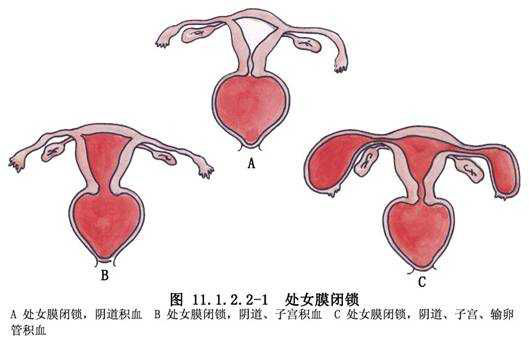 10至13岁女孩处女膜破裂视频，真实案例警示，家长必看防护指南