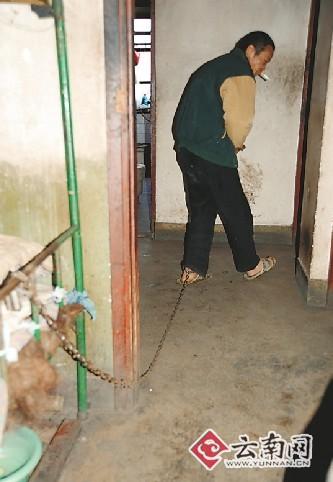 1.绳精病困扰生活如何应对绳精病