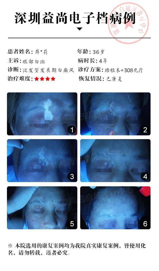2.胬肉治疗最新技术，传统疗法对比，术后护理要点解析