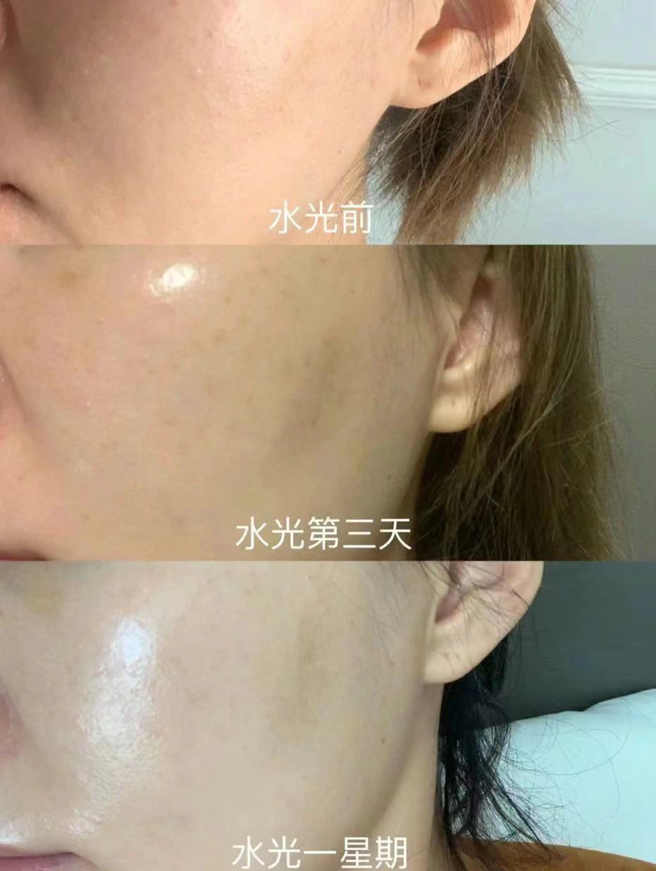 色婷摩护肤秘籍，轻松焕颜，告别暗沉，重现青春光彩