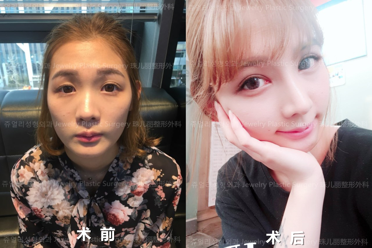 一级ass卖婬pics揭秘暗网交易内幕，真实案例曝光，黑色产业链调查