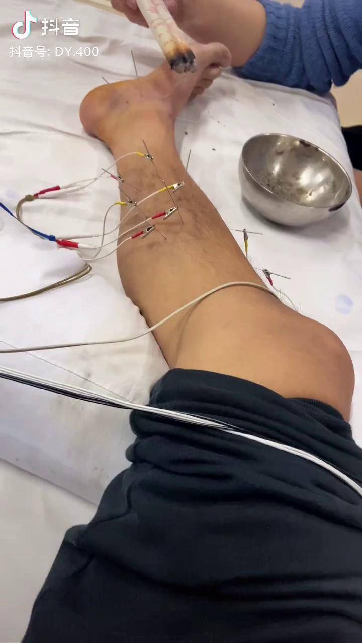 自由体育生训练必备导管素材推荐,提升表现,安全舒适,专业选择 自由体育生训练必备导管素材推荐,提升表现,安全舒适,专业选择