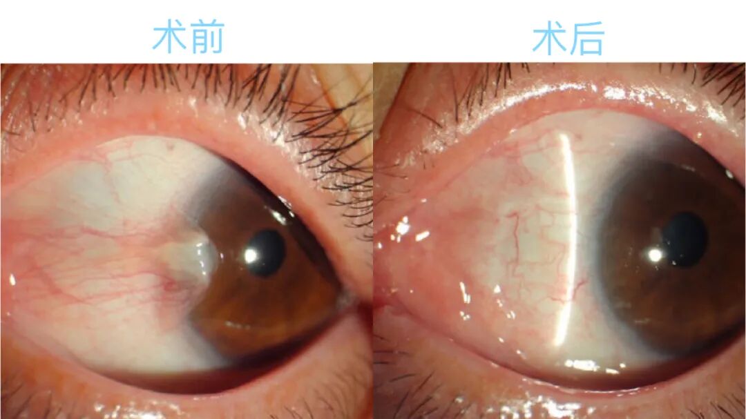 意大利电影胬肉治疗免费观看浜，高清完整版在线播放，精彩剧情不容错过