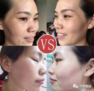 45岁极品少妇的保养秘诀,揭秘逆龄美颜,展现成熟魅力与自信风采 45岁极品少妇的保养秘诀,揭秘逆龄美颜,展现成熟魅力与自信风采